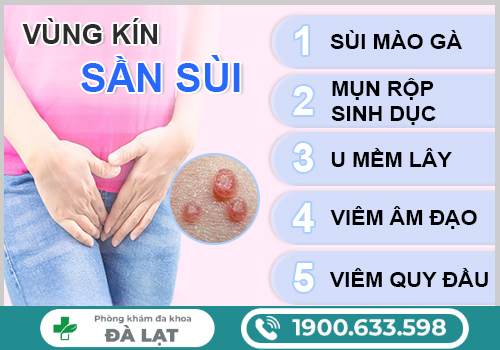 Hình ảnh minh họa